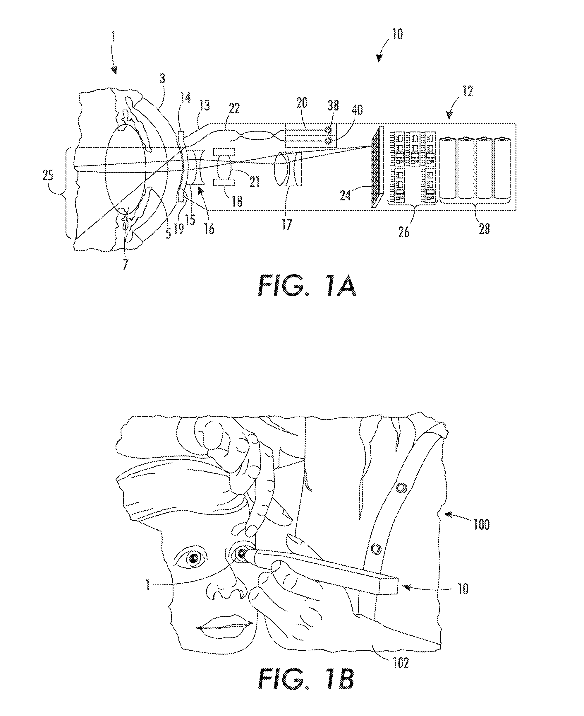 Portable fundus camera