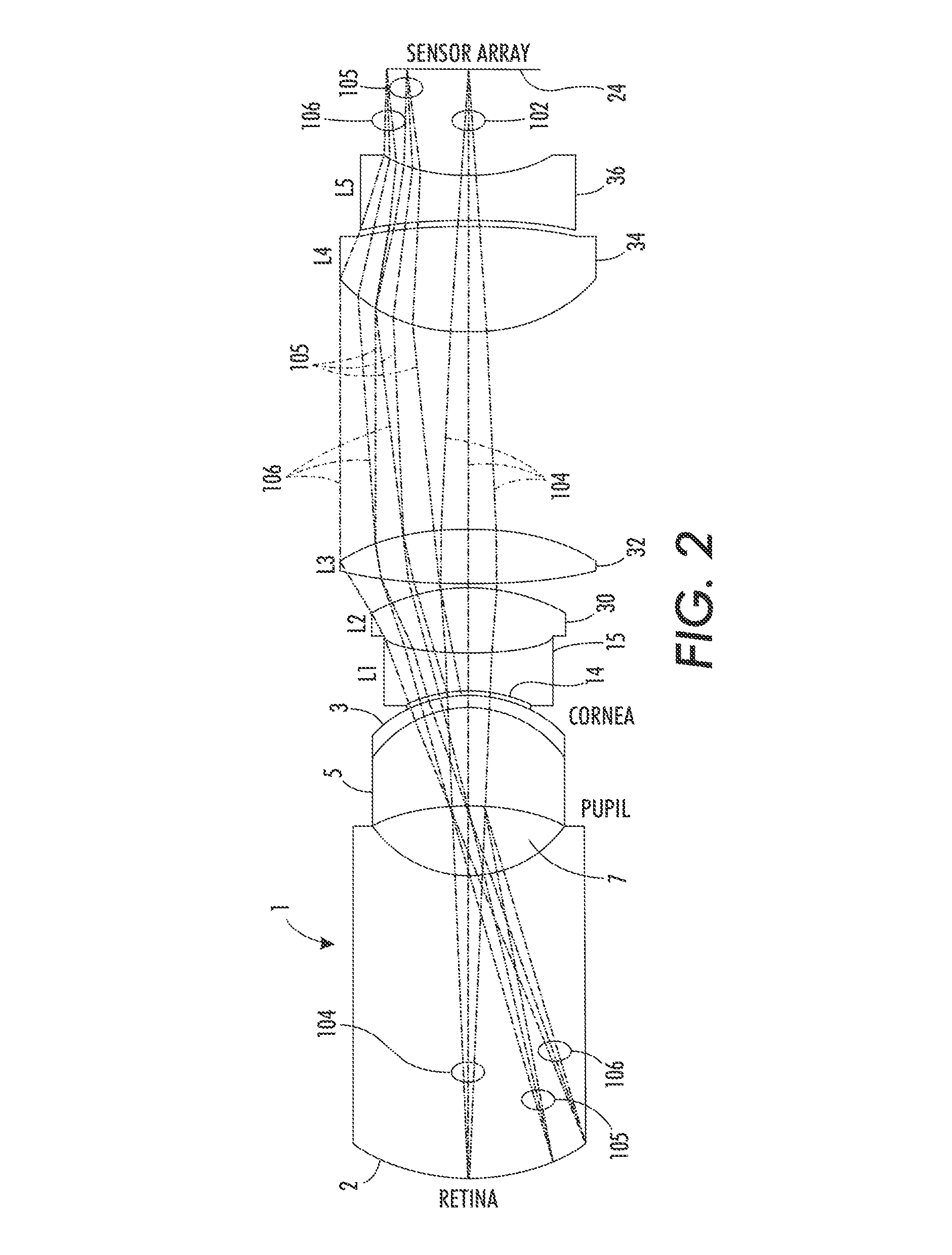 Portable fundus camera