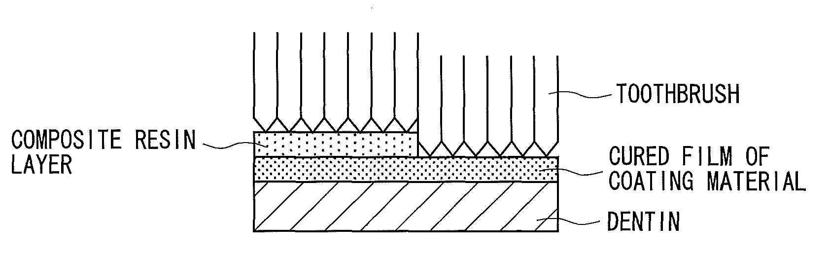 One-package type tooth surface coating material