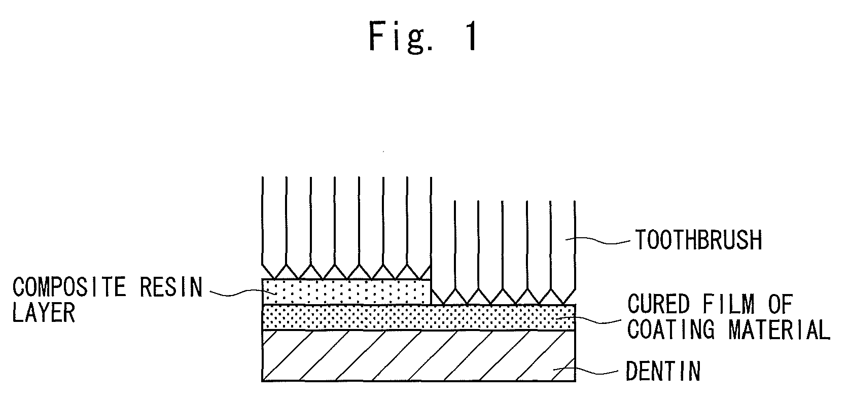 One-package type tooth surface coating material