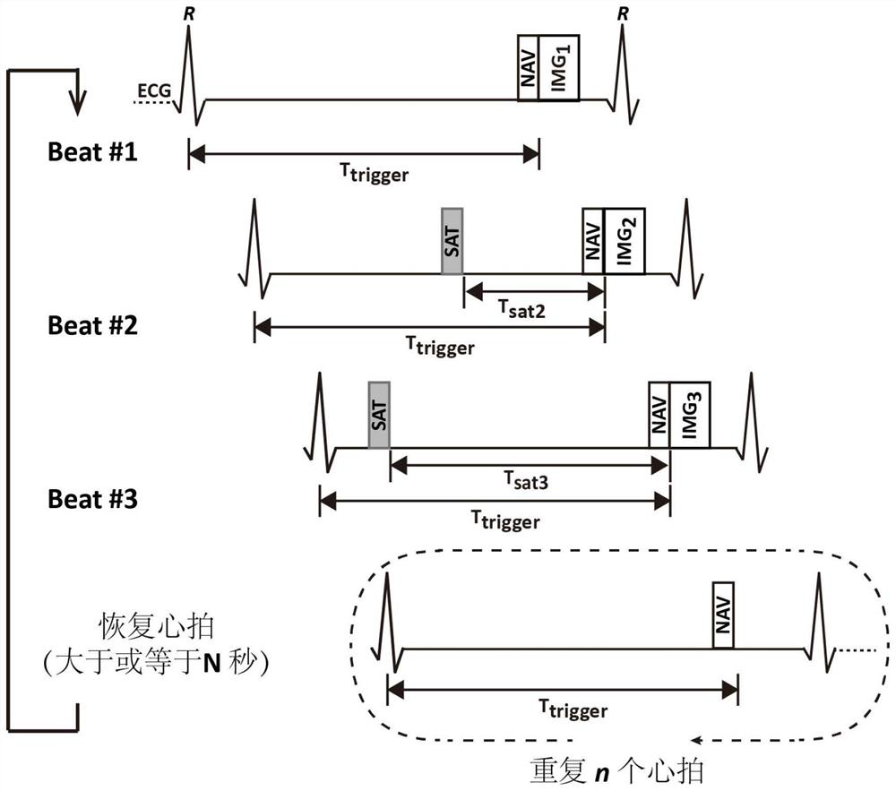 Myocardial quantitative magnetic resonance imaging method, equipment and storage medium