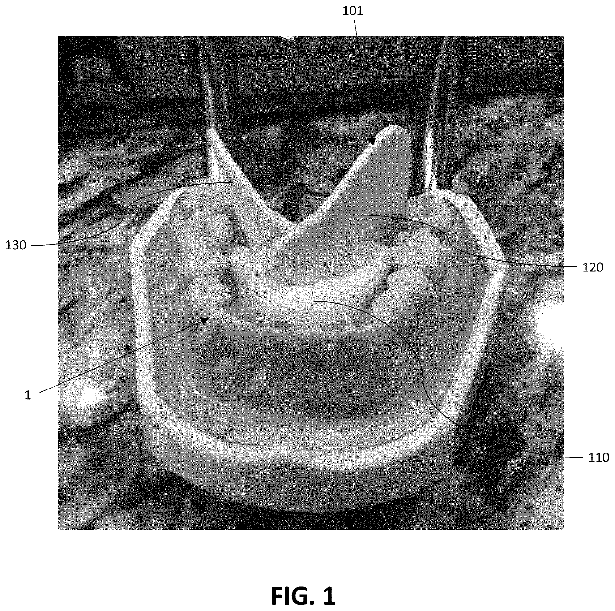 Dental Apparatus For Restricting Tongue Movement During Examinations And Procedures