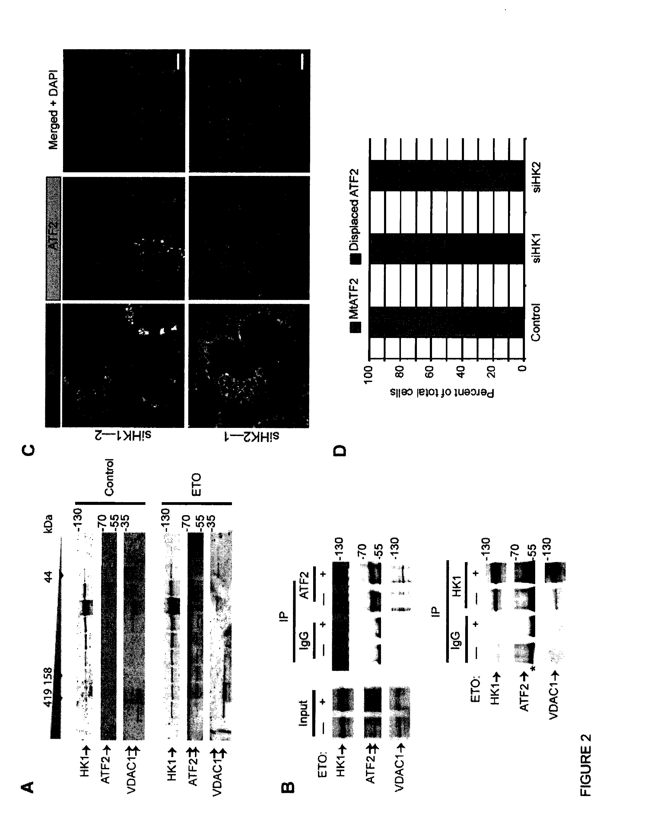 Methods for diagnosis and treatment of cellular proliferative disorders