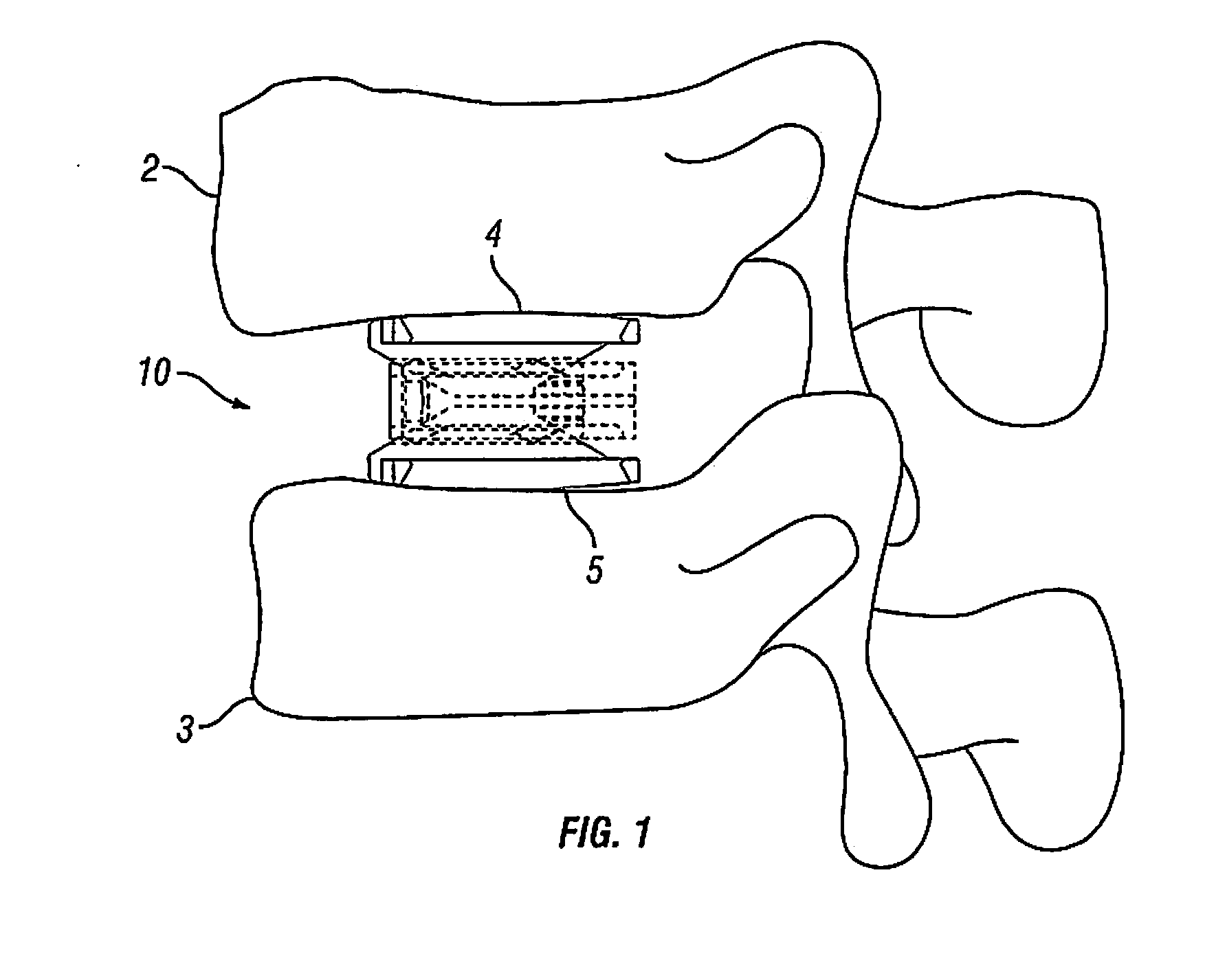 Expandable Fusion Device and Method of Installation Thereof