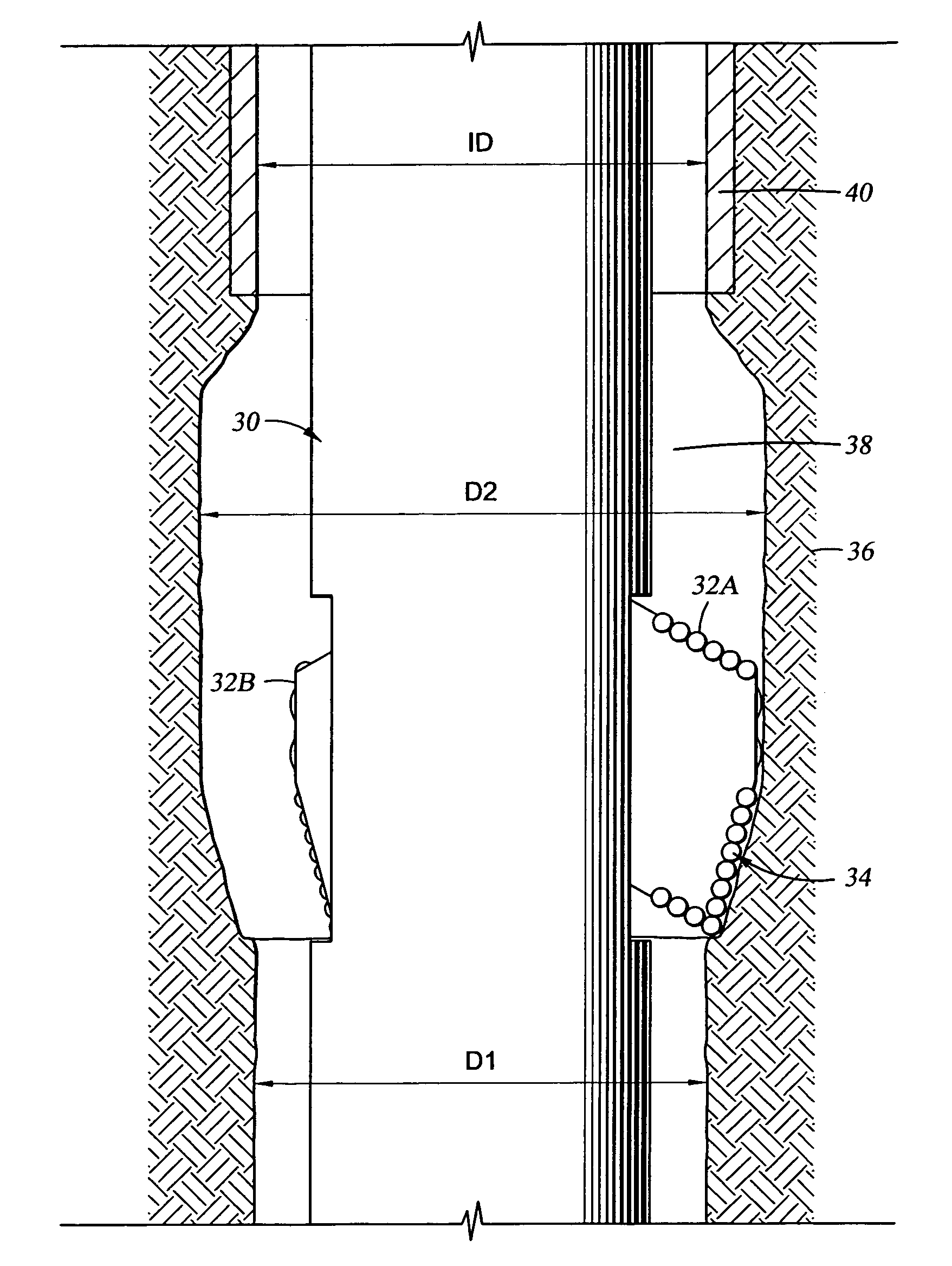 Advanced expandable reaming tool