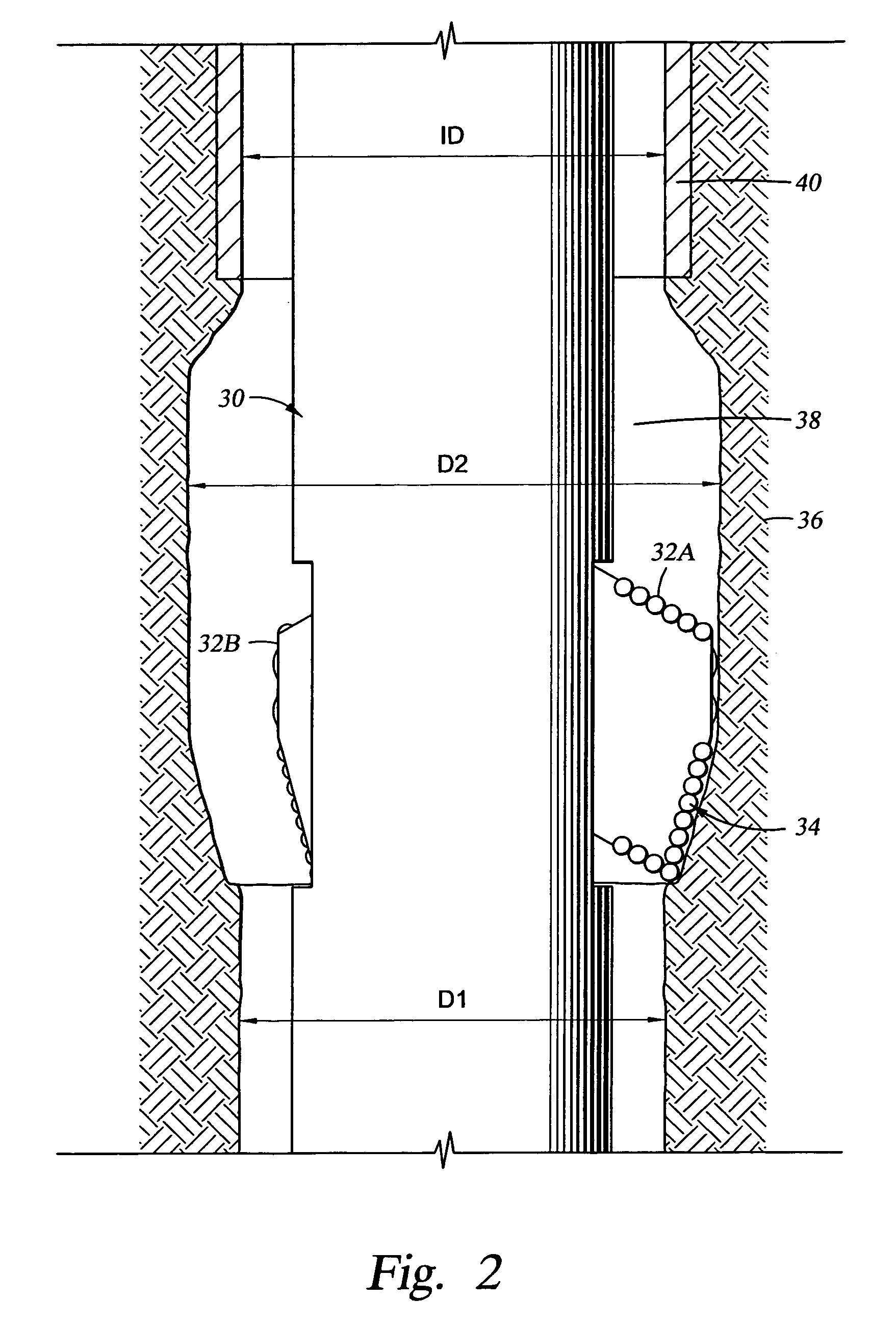 Advanced expandable reaming tool