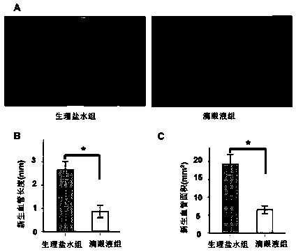 Application of Tripterygium in the Preparation of Eye Drops for Inhibiting Corneal Neovascularization and Promoting Corneal Alkali Burn Healing