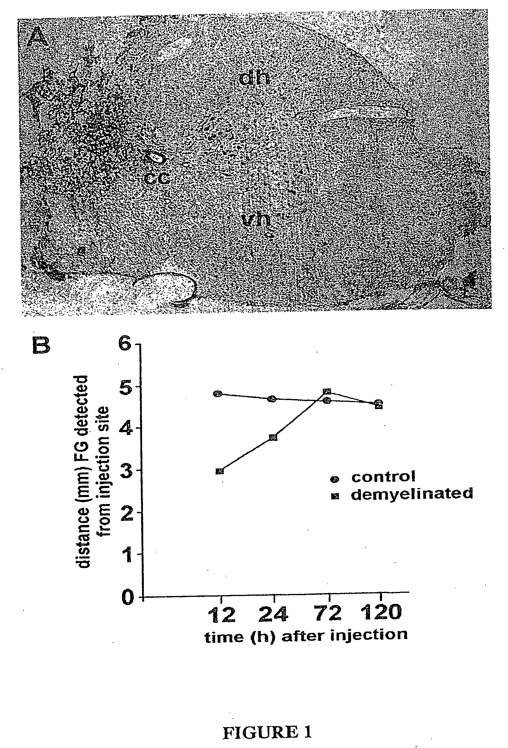 Composition for neuronal regeneration comprising myelin-specific antibodies and complement proteins