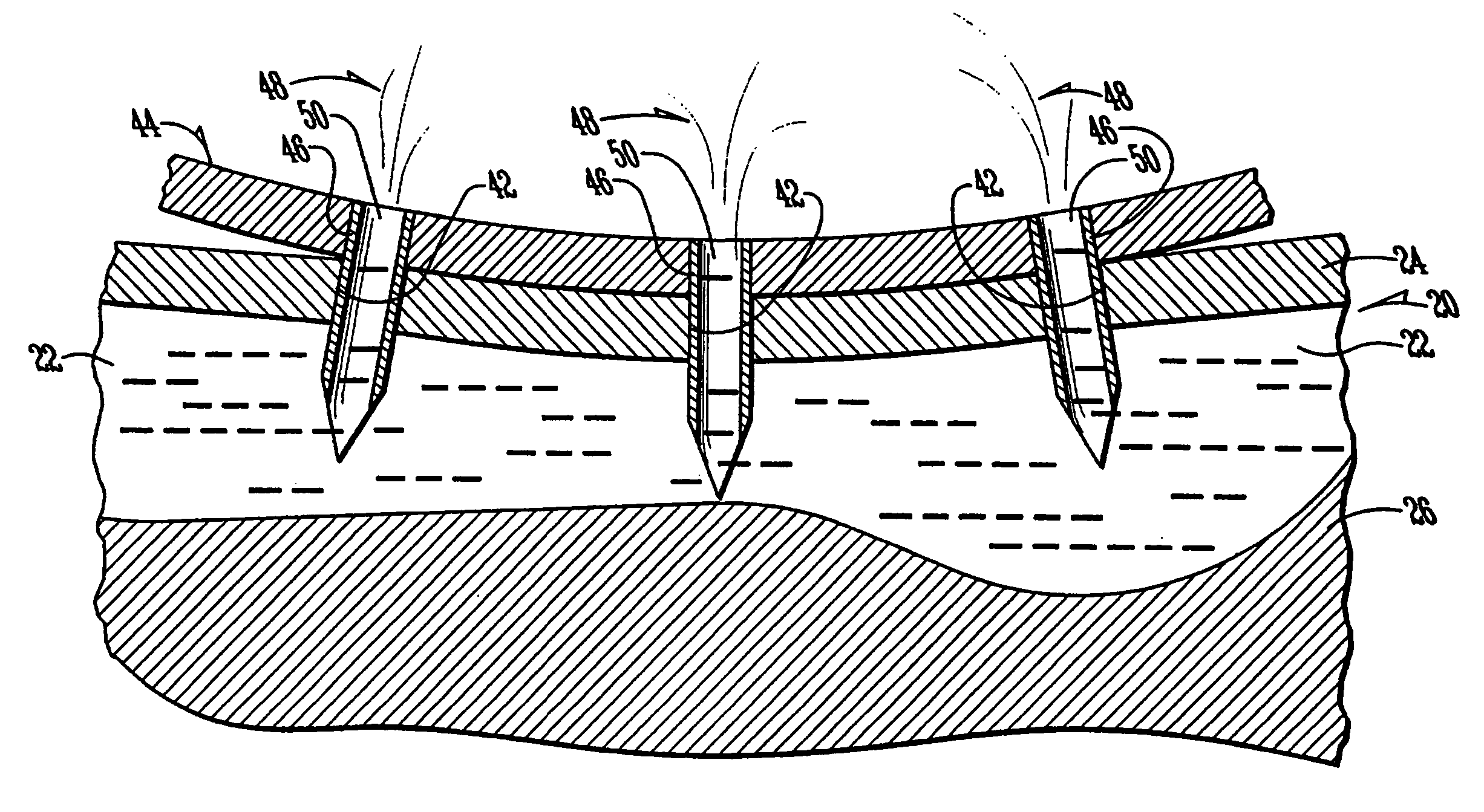 Method and apparatus for evacuating pockets of injected fluid in meat products