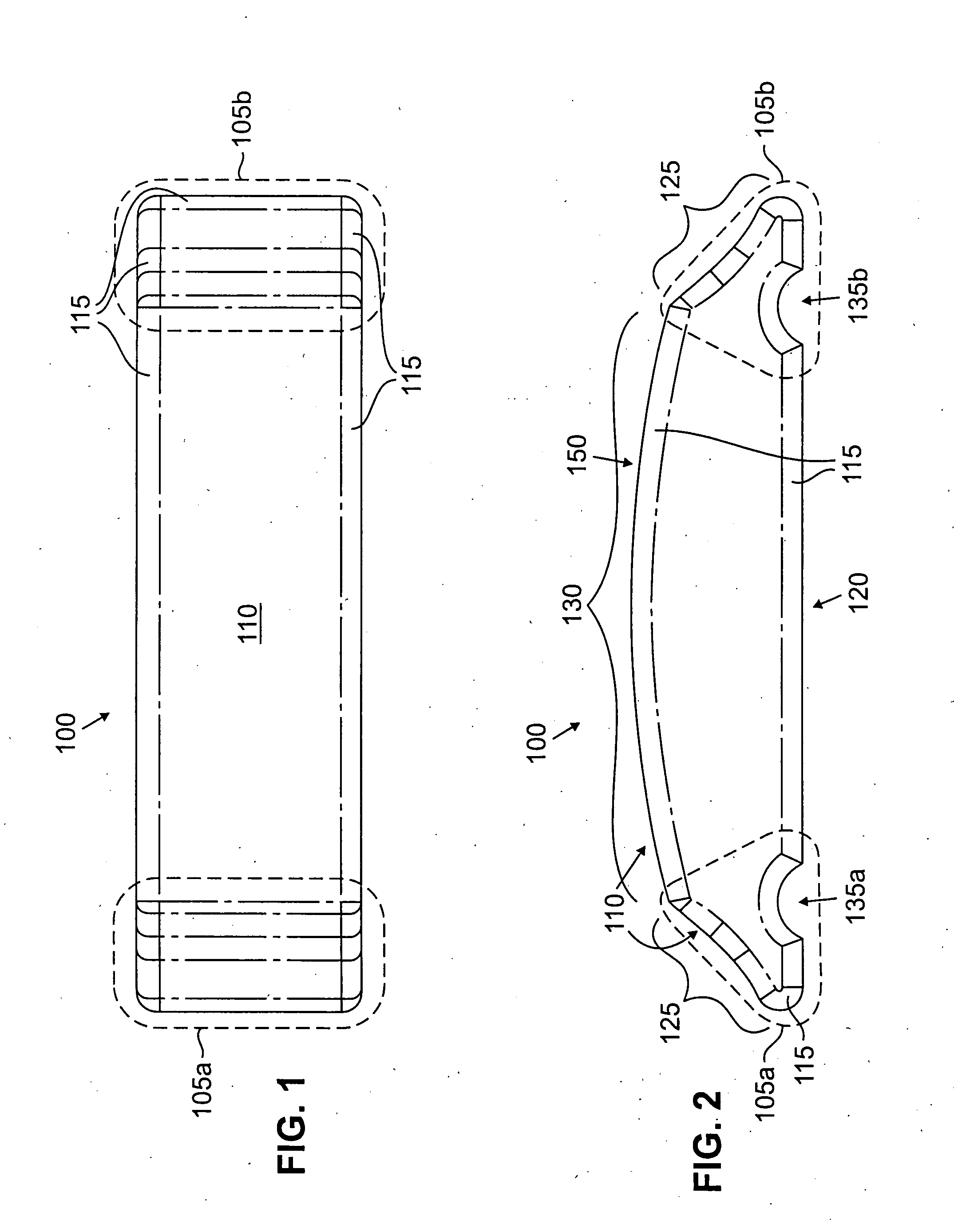 Scleral prosthesis for treatment of presbyopia and other eye disorders