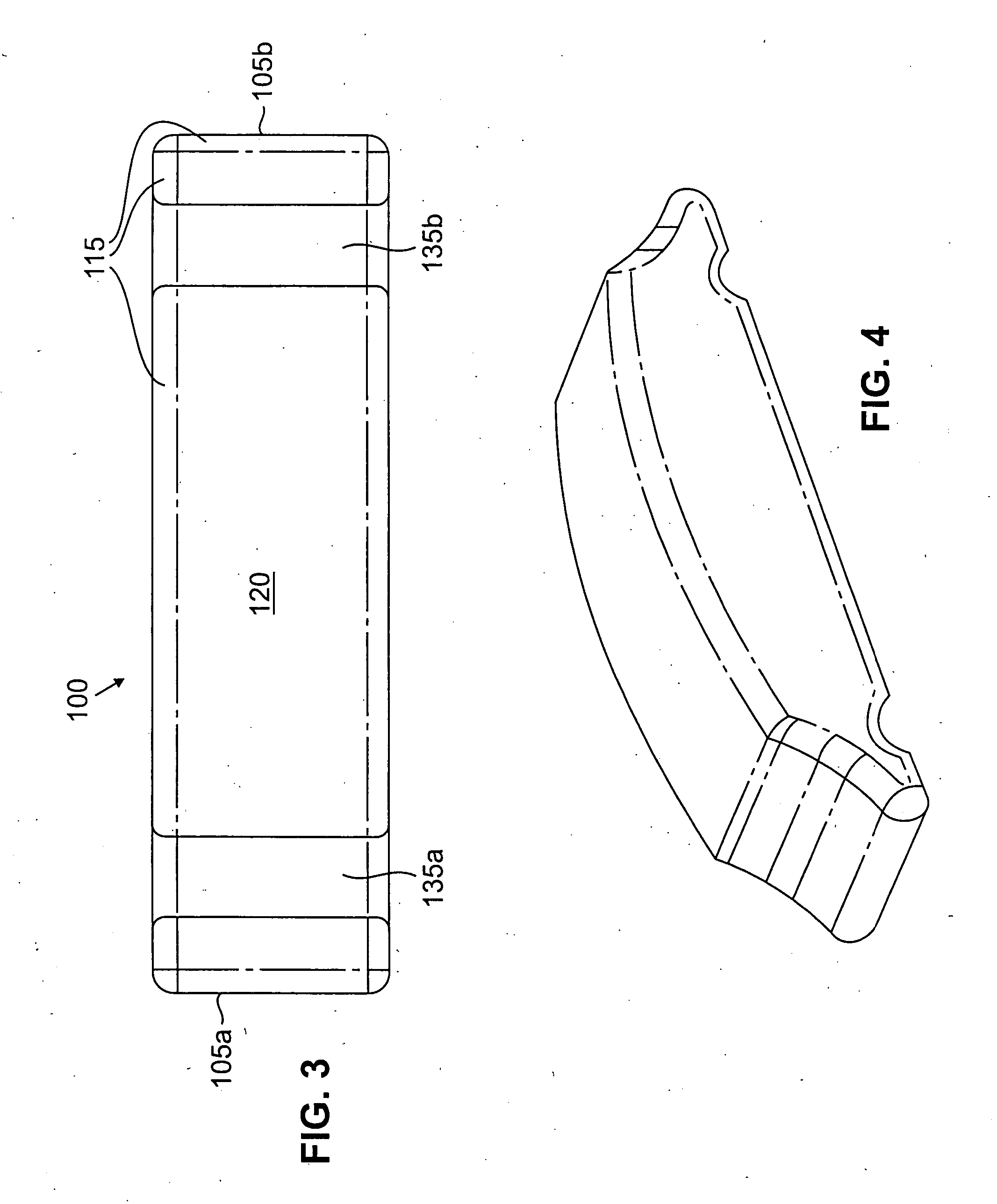 Scleral prosthesis for treatment of presbyopia and other eye disorders