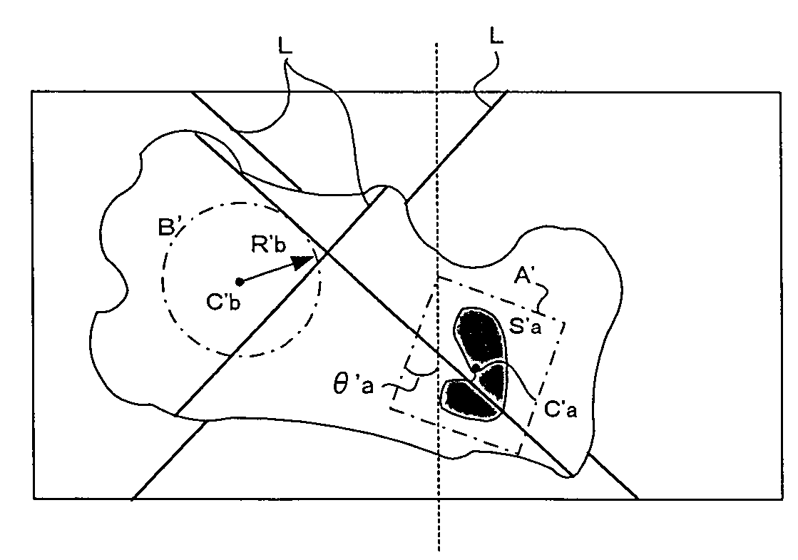 Three-dimensional visual sensor