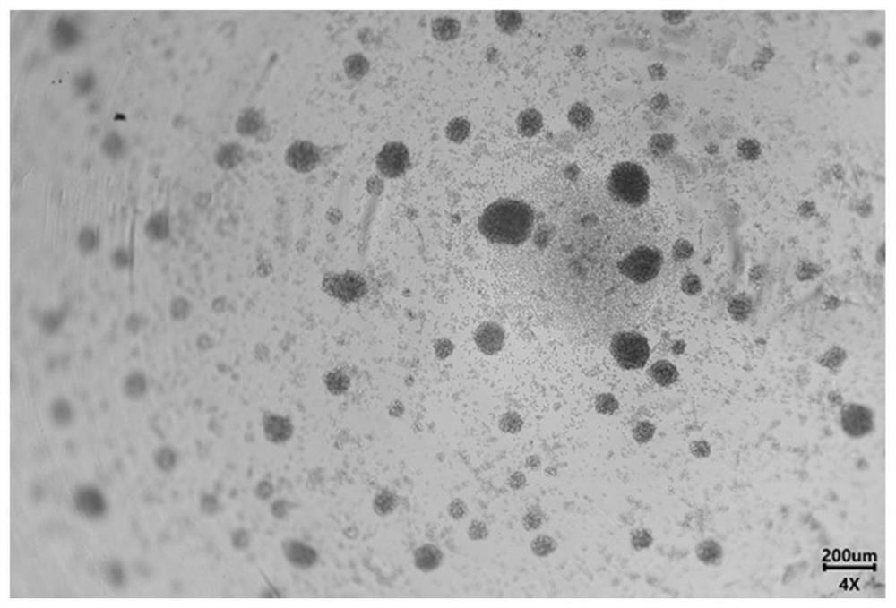 A method for cultivating and isolating tumor-specific til cells