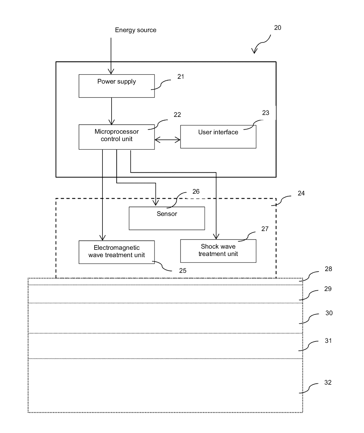 Methods and devices for tissue treatment using shock waves and electromagnetic field