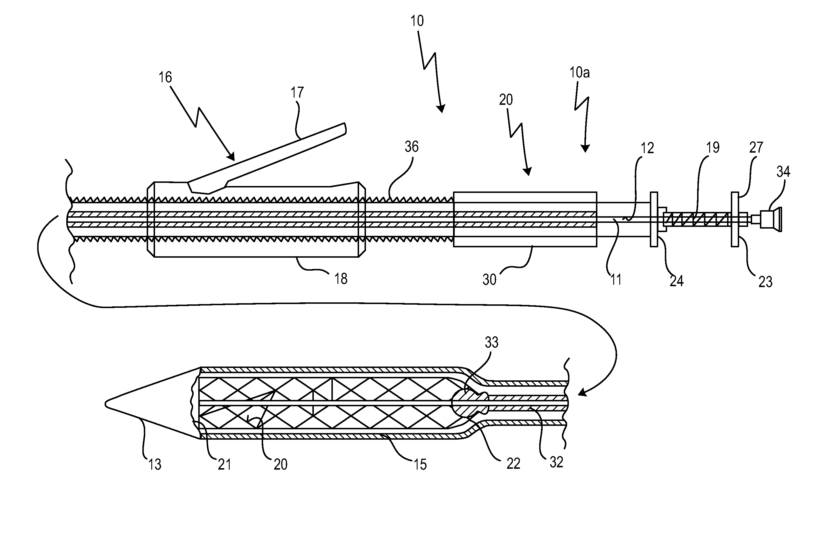 Cardiac valve prosthesis deployment system