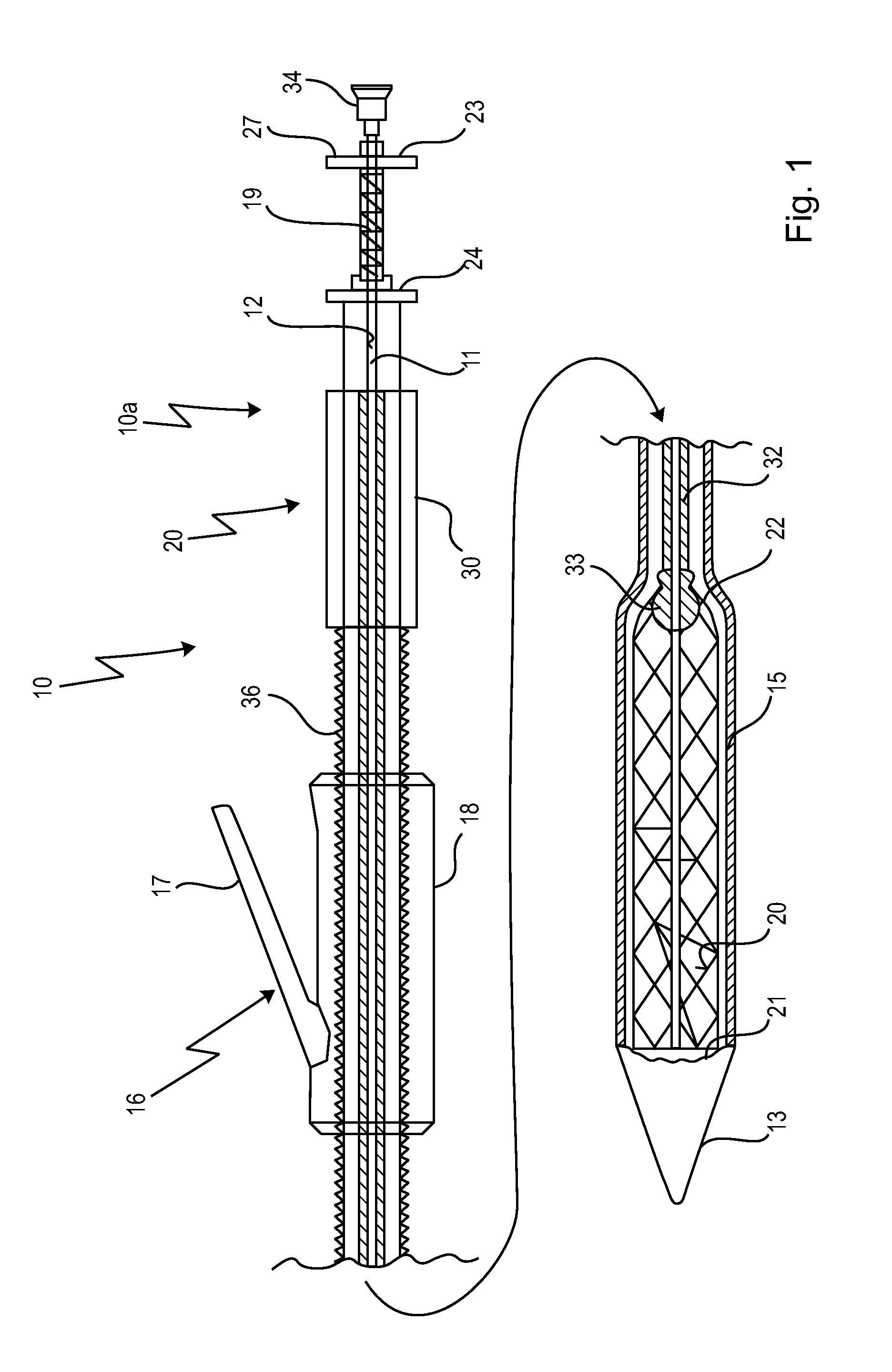 Cardiac valve prosthesis deployment system