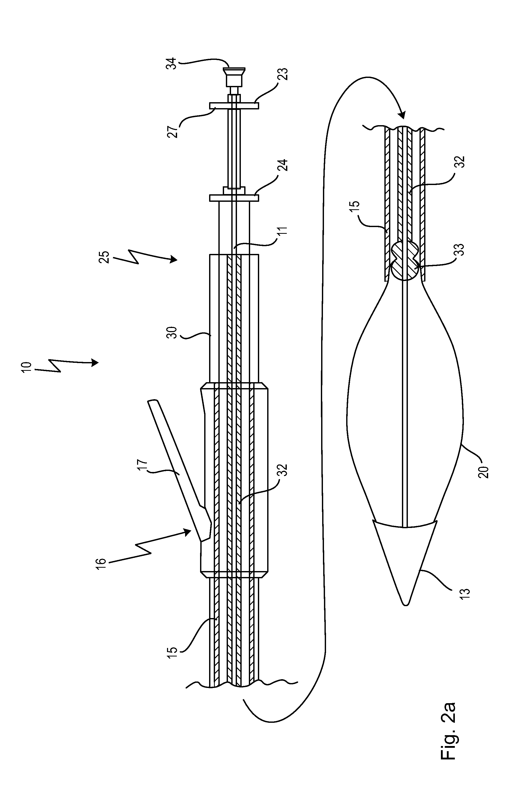 Cardiac valve prosthesis deployment system