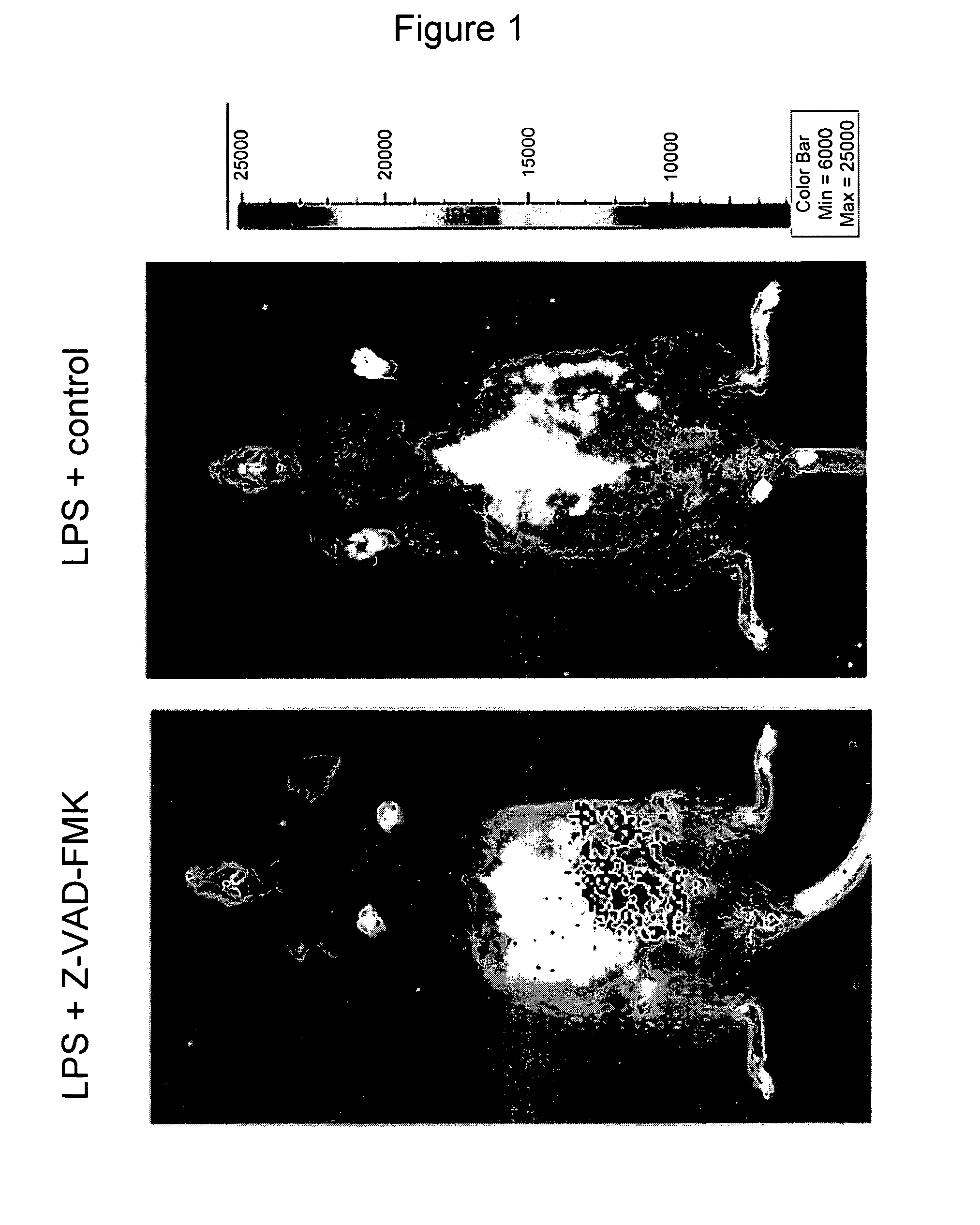 Caspase inhibitors in the treatment of infection-associated preterm delivery