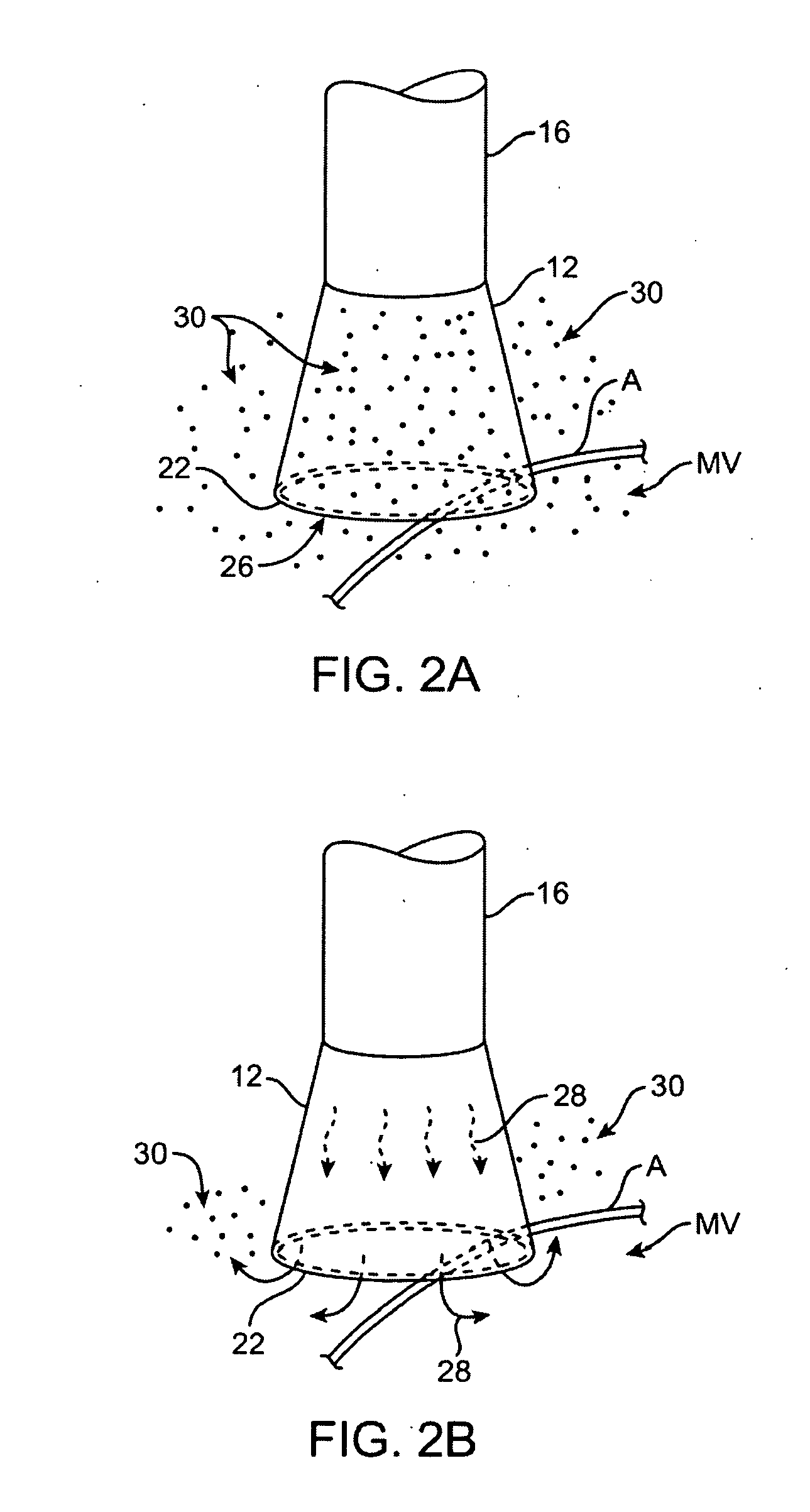 Tissue visualization catheter with imaging systems integration