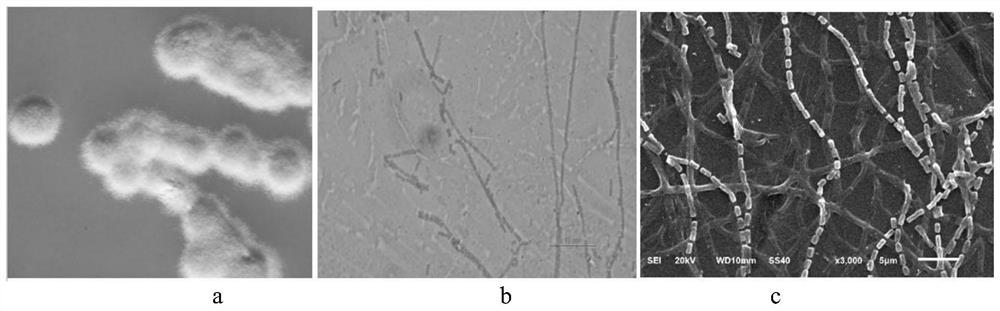 Streptomyces amritsarensis and its application