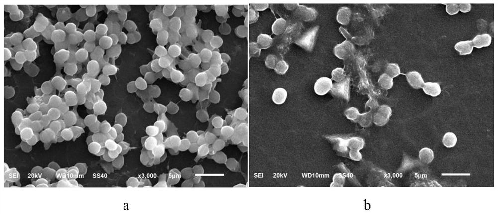 Streptomyces amritsarensis and its application