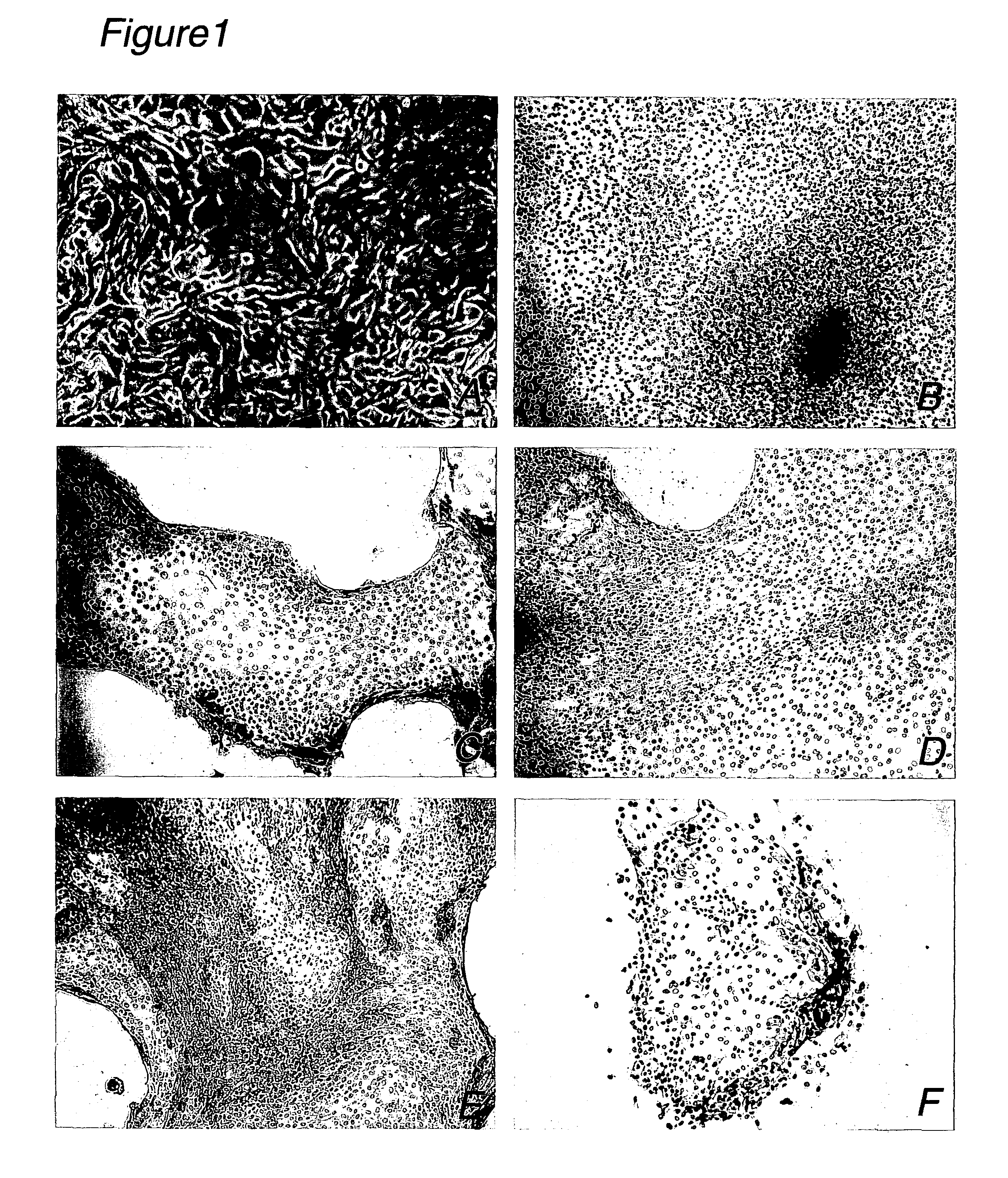 Human fetal bladder-derived epithelial cells