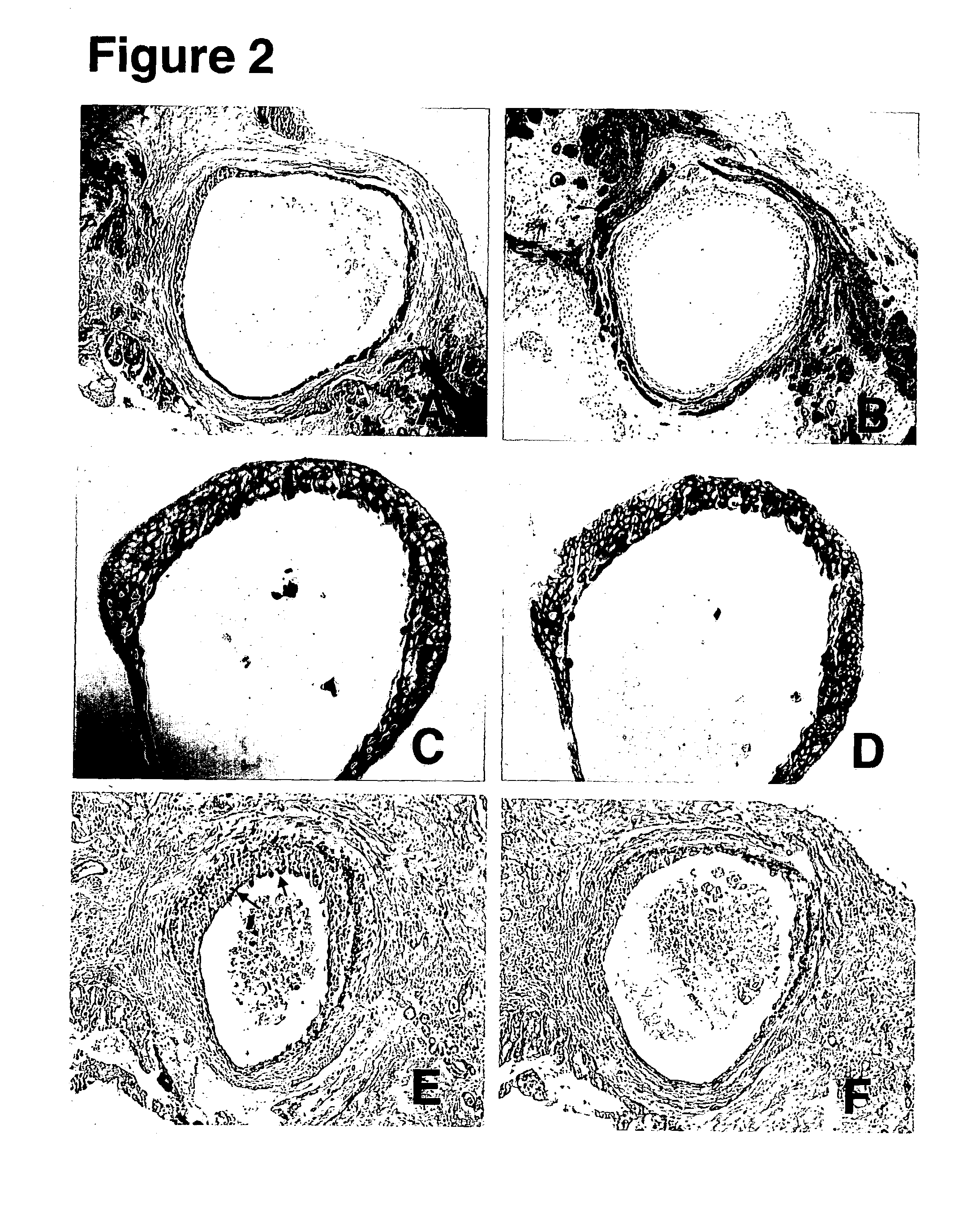 Human fetal bladder-derived epithelial cells