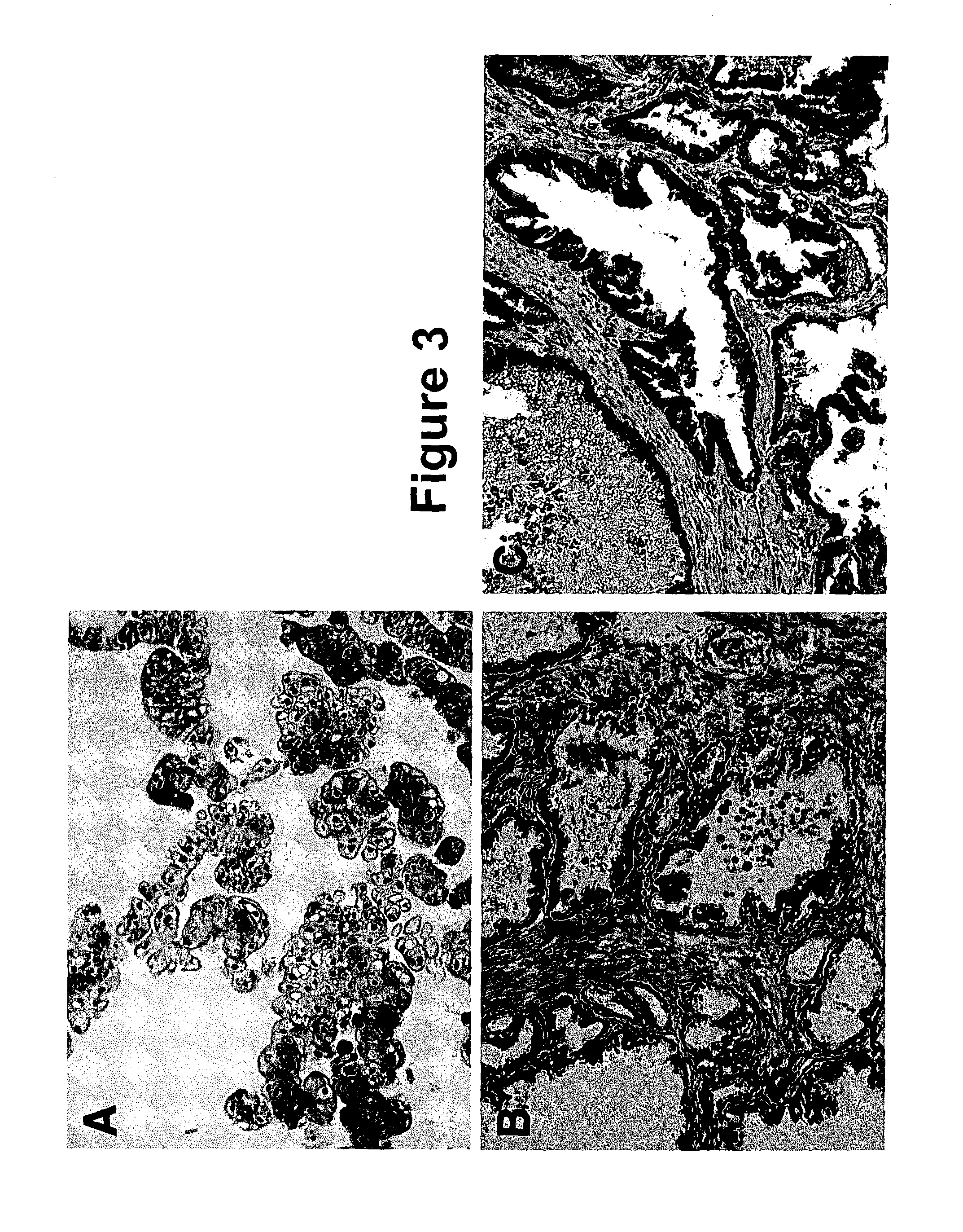 Human fetal bladder-derived epithelial cells