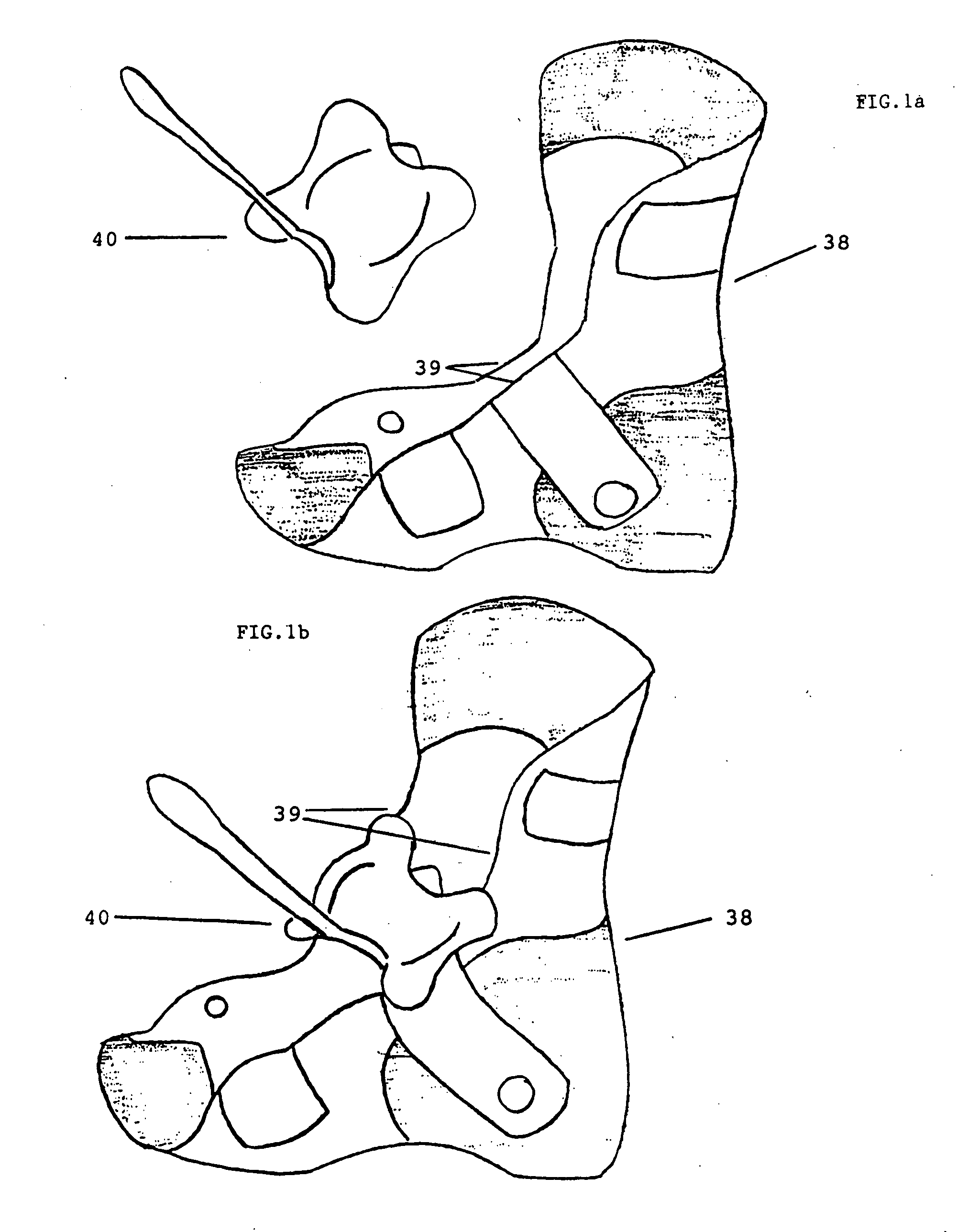 Donning facilitator for dorsal wrap-around ankle-foot orthosis