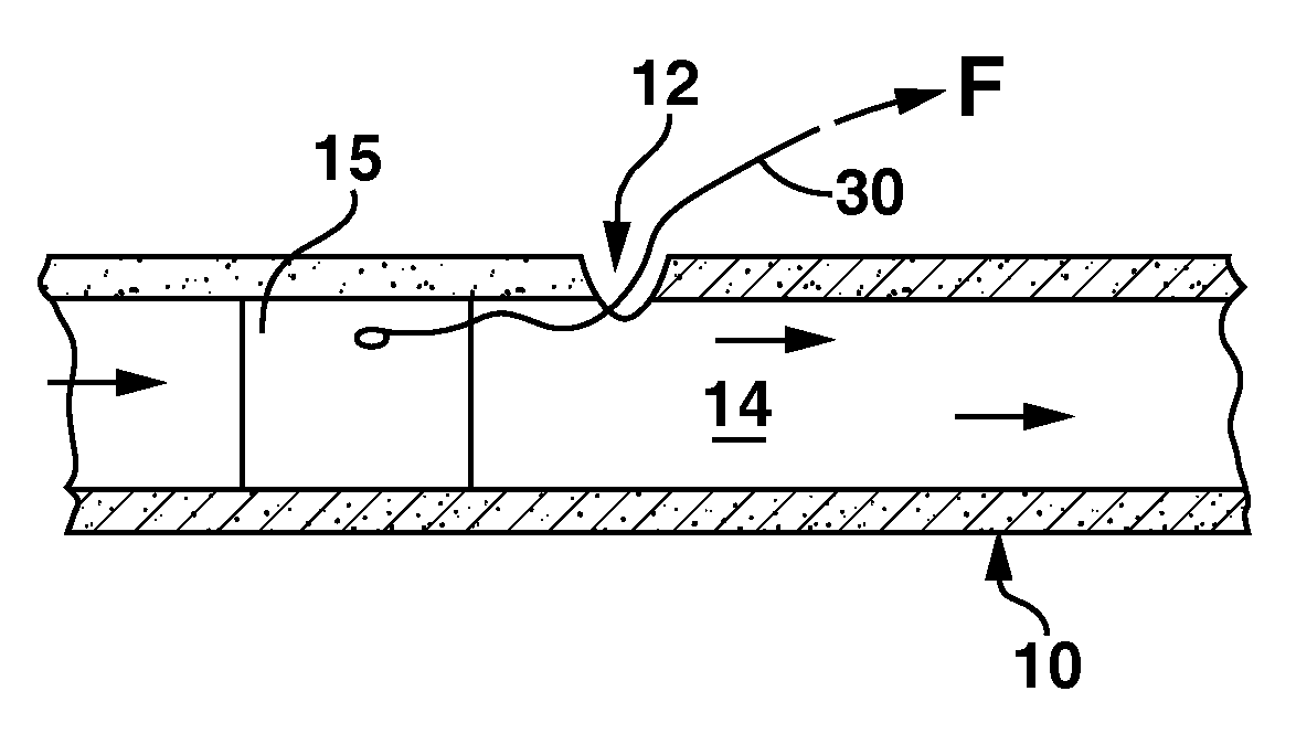 Systems and Methods for Closing a Percutaneous Vascular Puncture