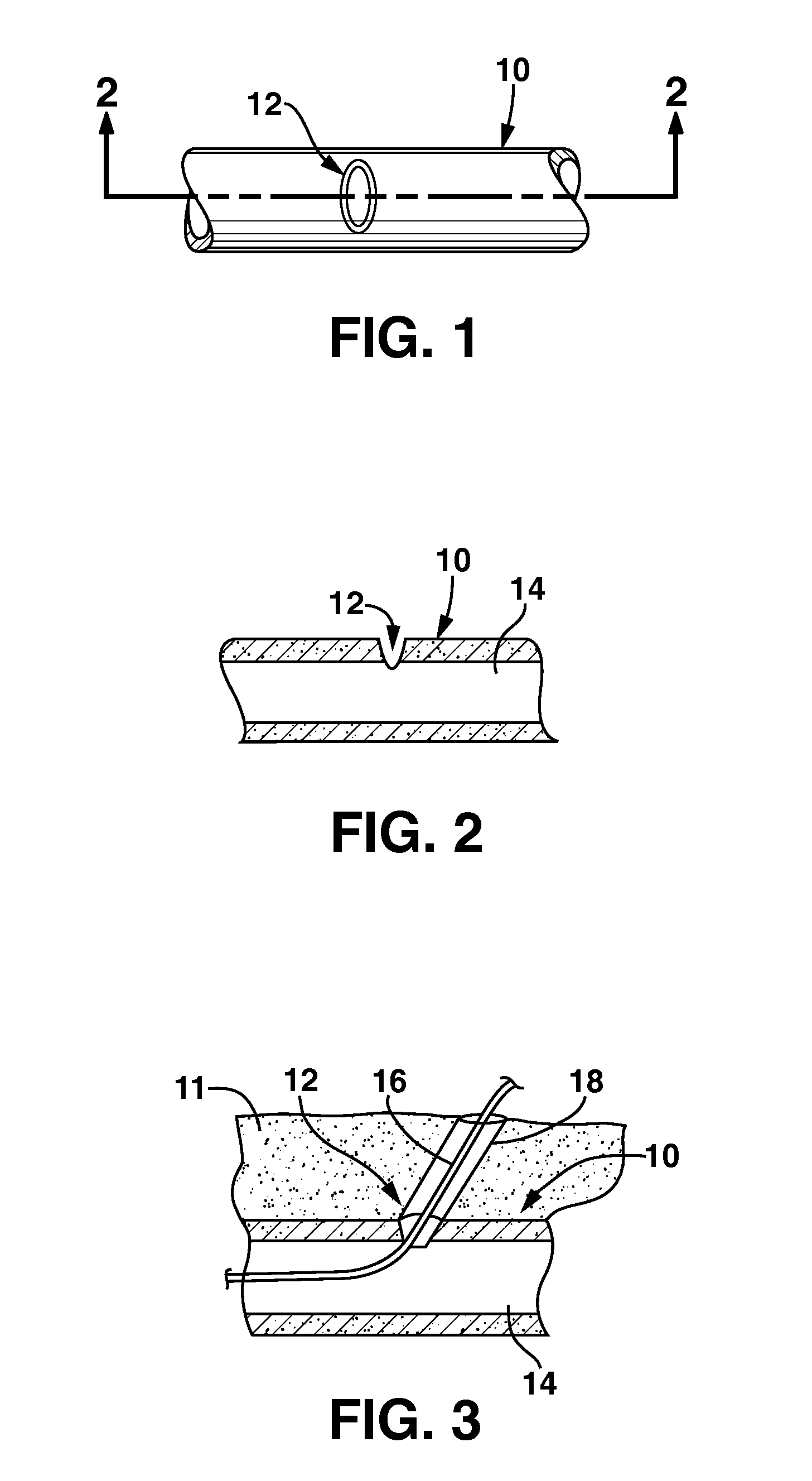 Systems and Methods for Closing a Percutaneous Vascular Puncture