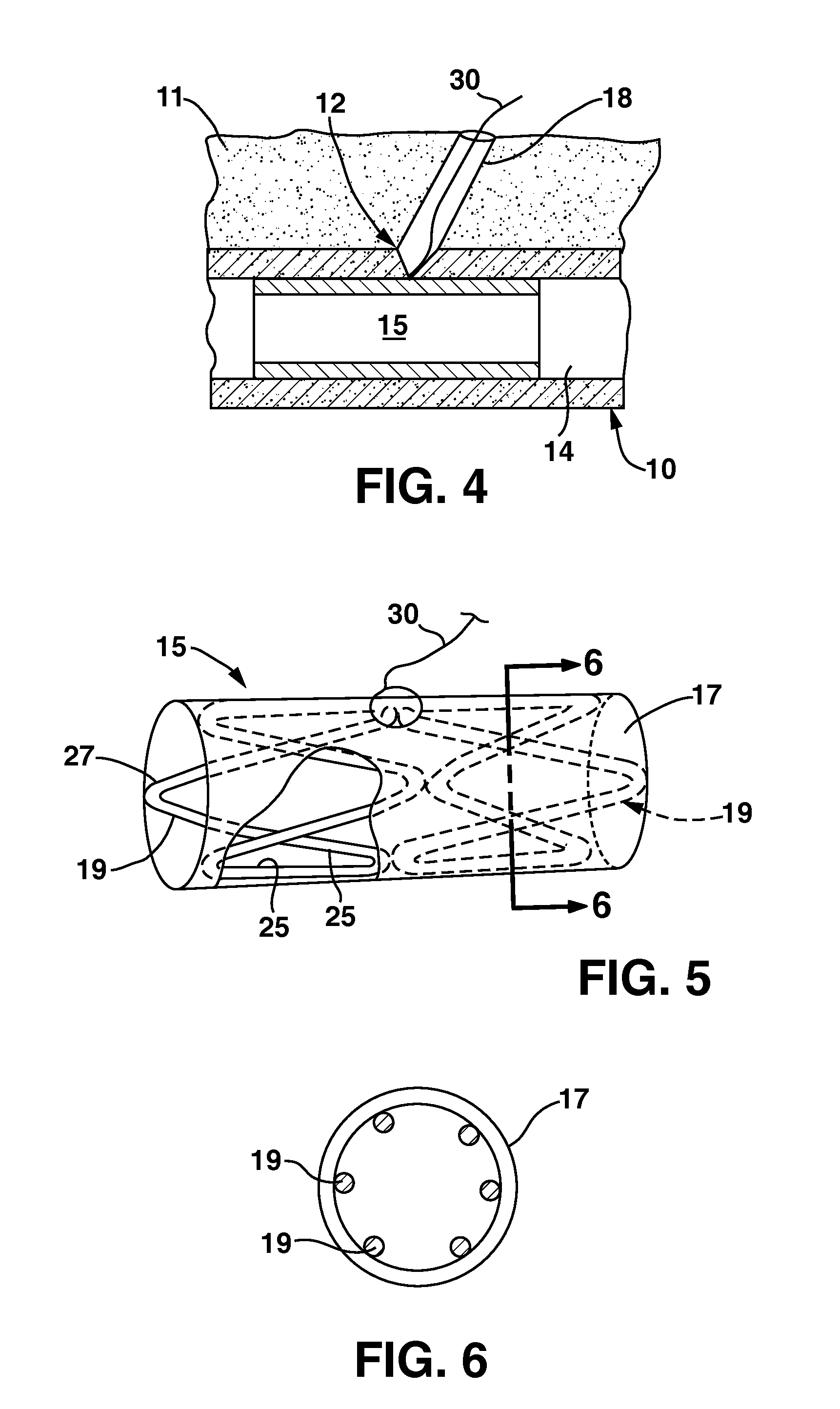 Systems and Methods for Closing a Percutaneous Vascular Puncture