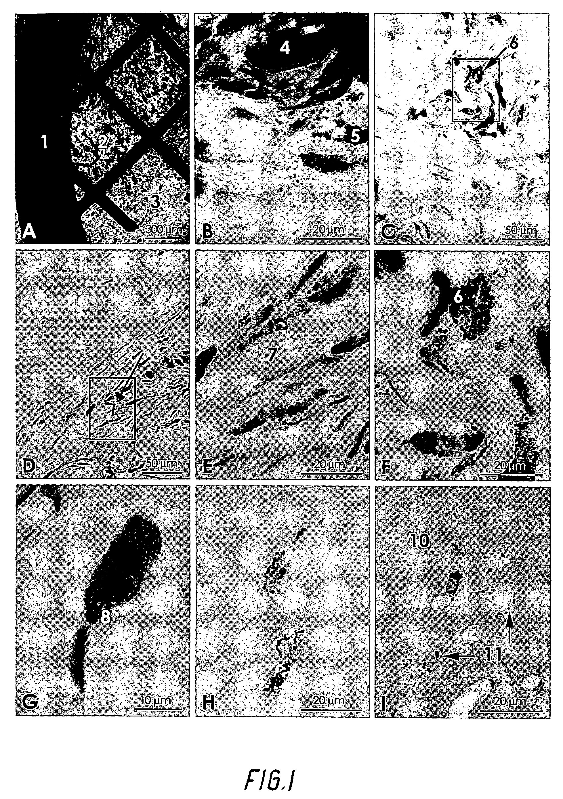 Medicament and method of treatment of patients with heavy metals