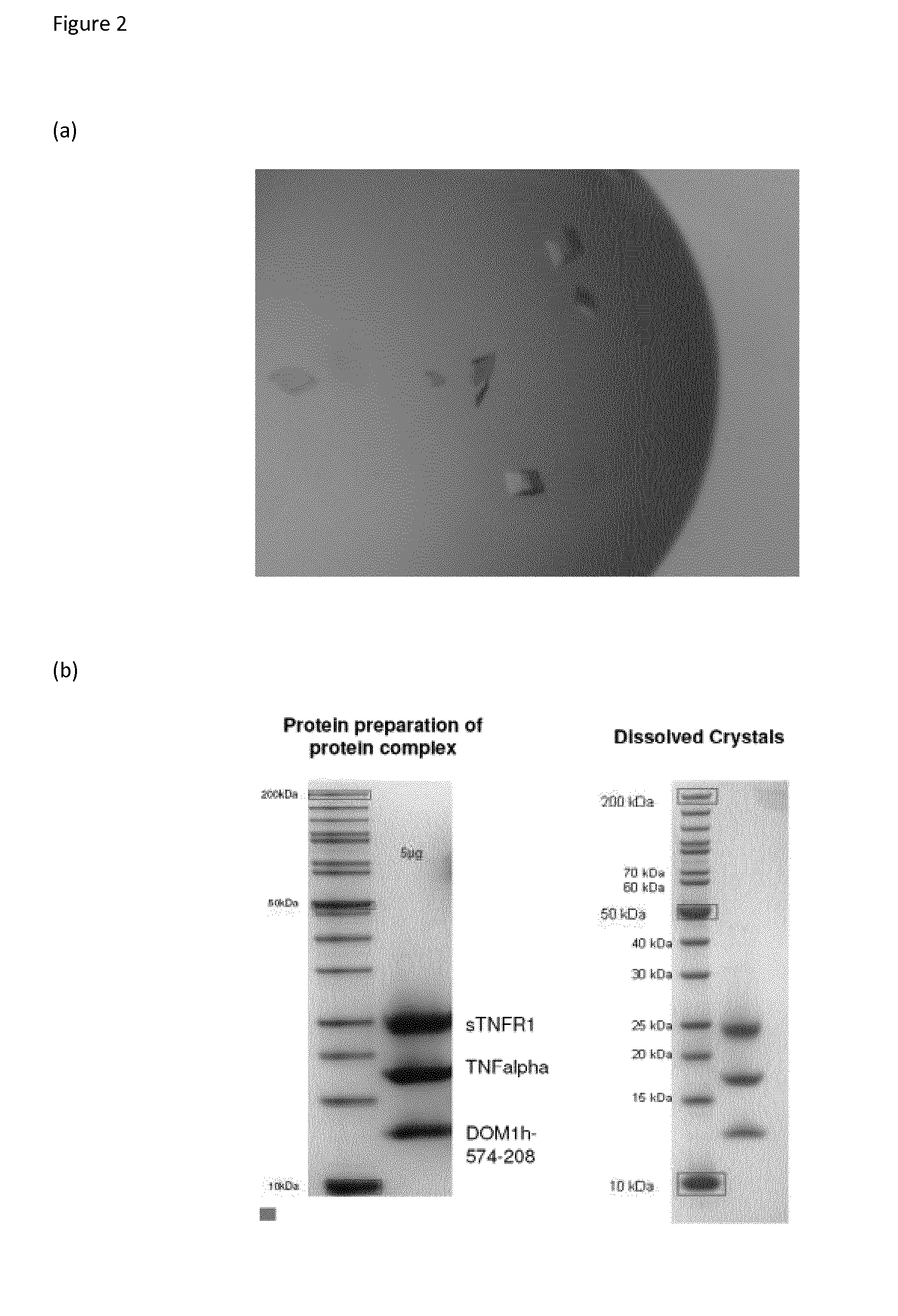 Tumour necrosis factor receptor 1 antagonists