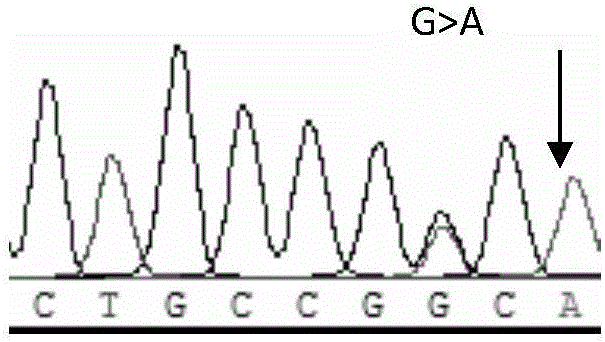 Molecular marker related to sperm activity character of boar and application