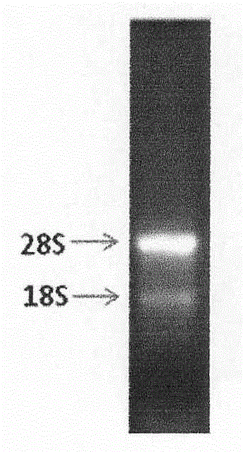 Enzyme-linked immune sorbent assay (ELISA) kit for detecting Shiga toxin II (StxII)