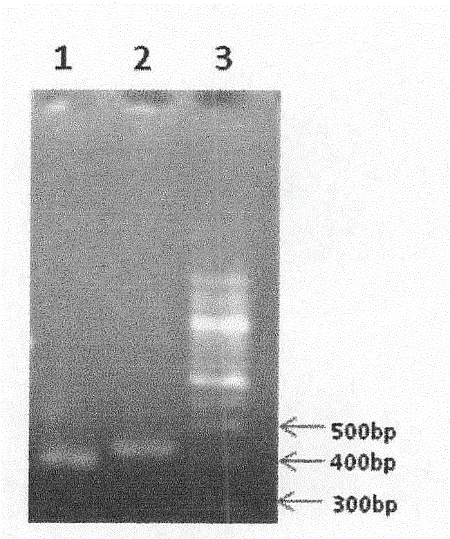 Enzyme-linked immune sorbent assay (ELISA) kit for detecting Shiga toxin II (StxII)