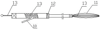 Volume-reducing stomach stent