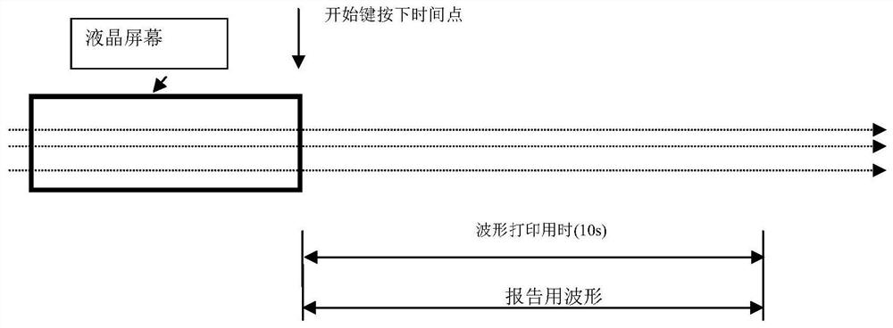 A method for rapid examination of electrocardiogram