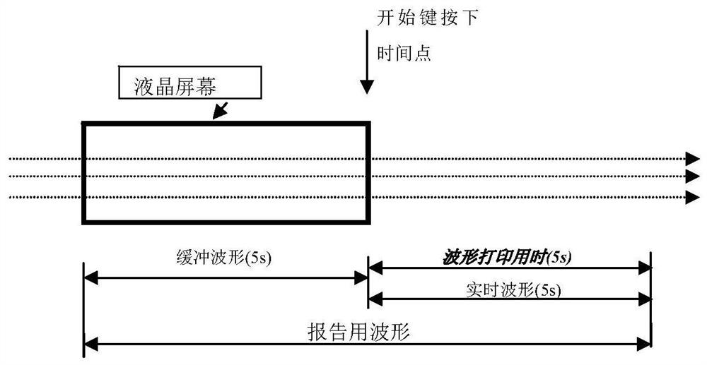 A method for rapid examination of electrocardiogram