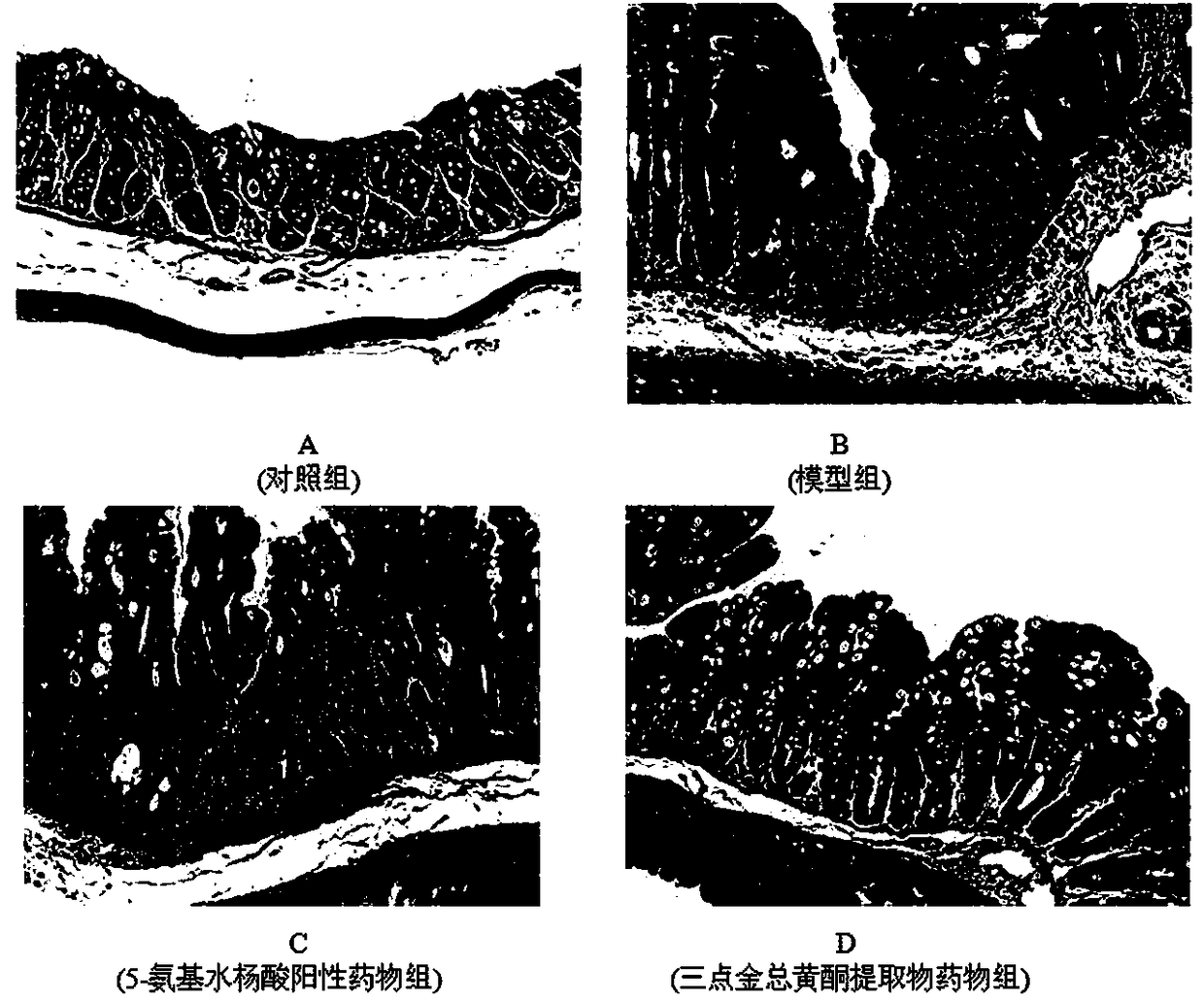 Application of desmodium triflorum herb total flavonoid extract in preparation of drugs for preventing/treating ulcerative colitis