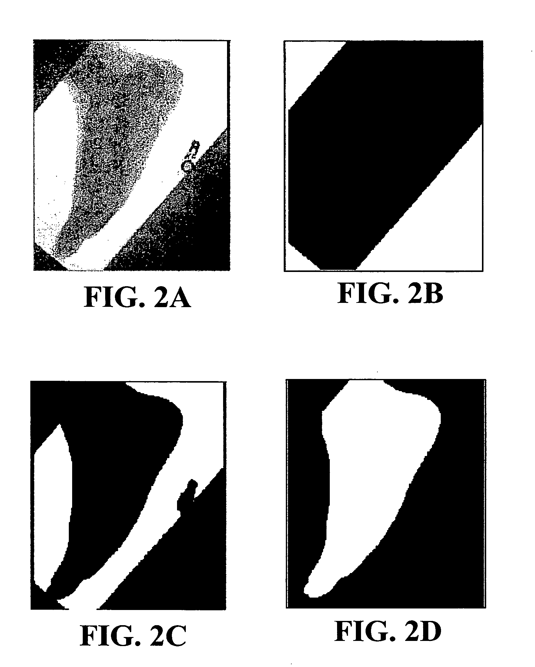 Automated radiograph classification using anatomy information