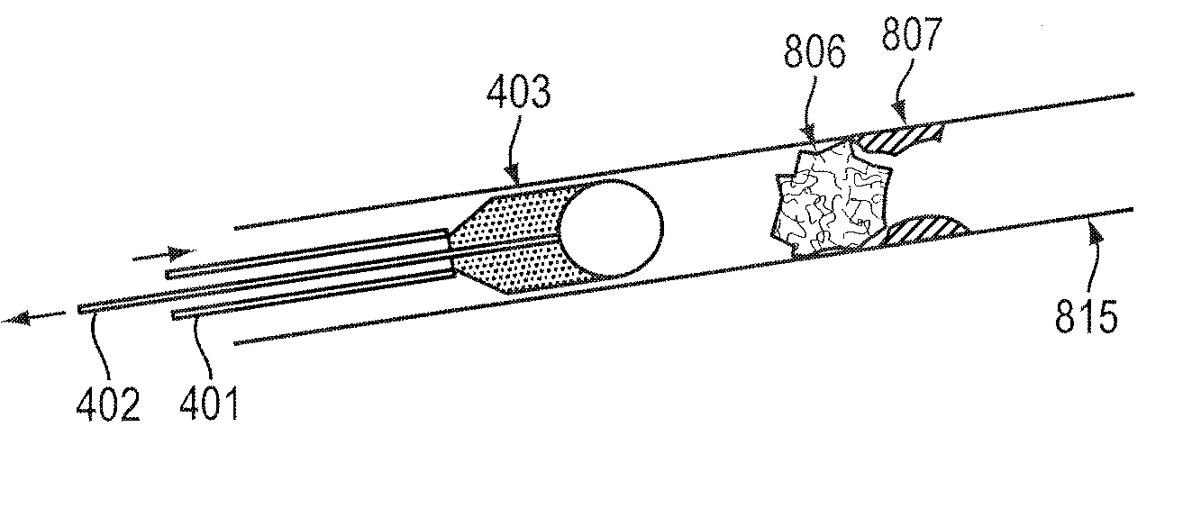 System and method for removal of material from a  blood vessel