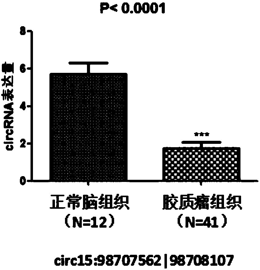 Glioma prognostic marker circ15:98707562|98708107 and applications