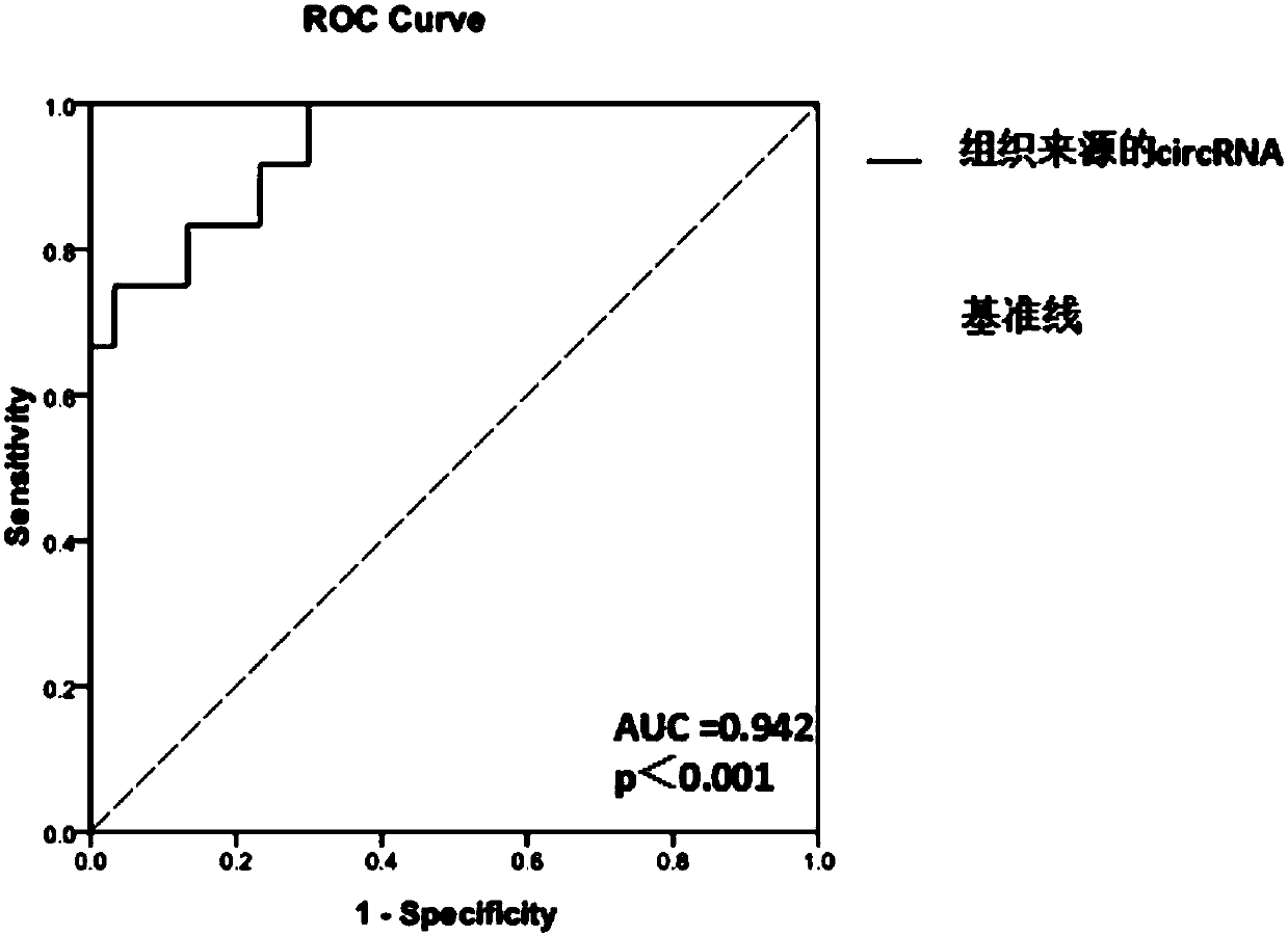 Glioma prognostic marker circ15:98707562|98708107 and applications