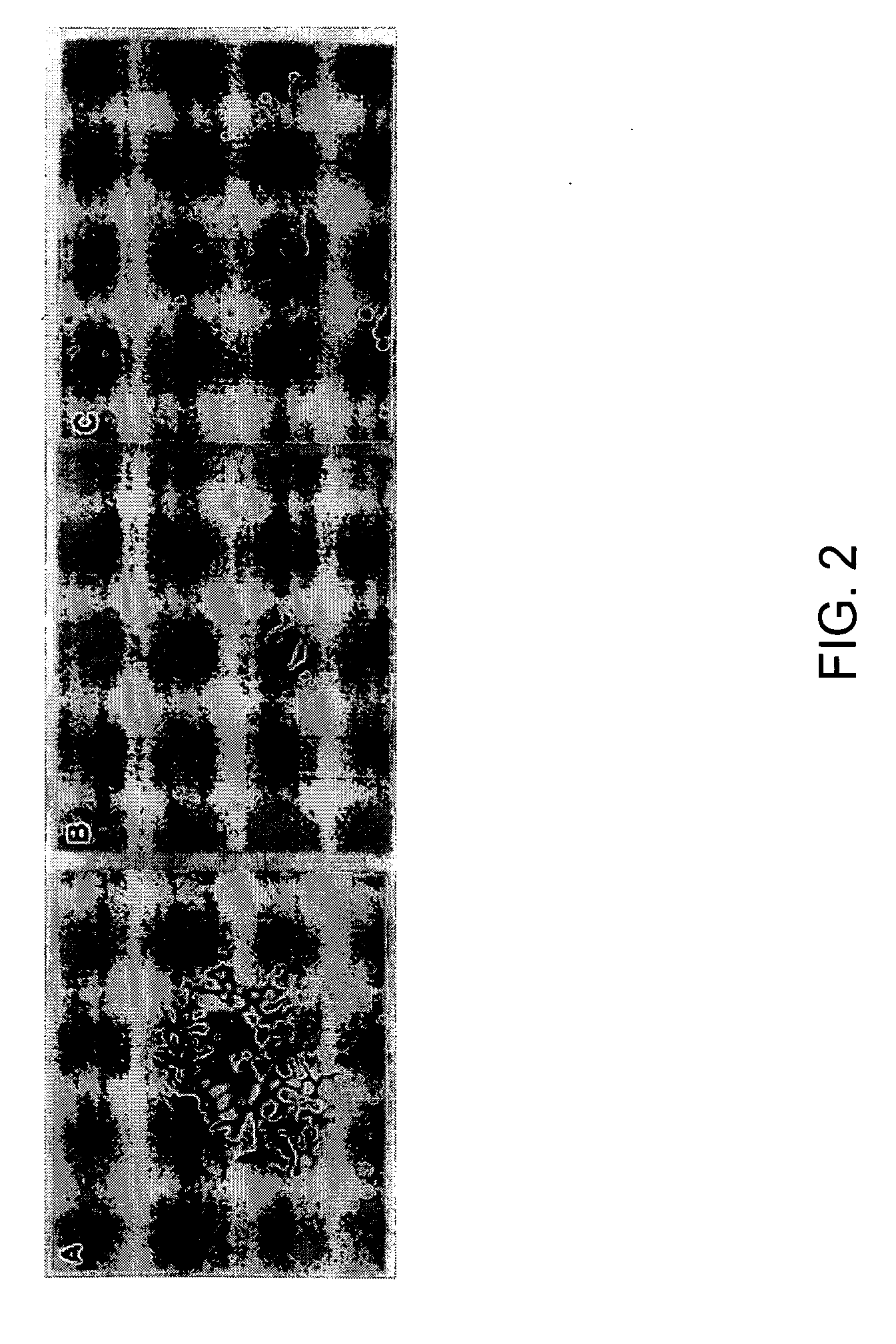 Pea15 as a Tumor Suppressor Gene