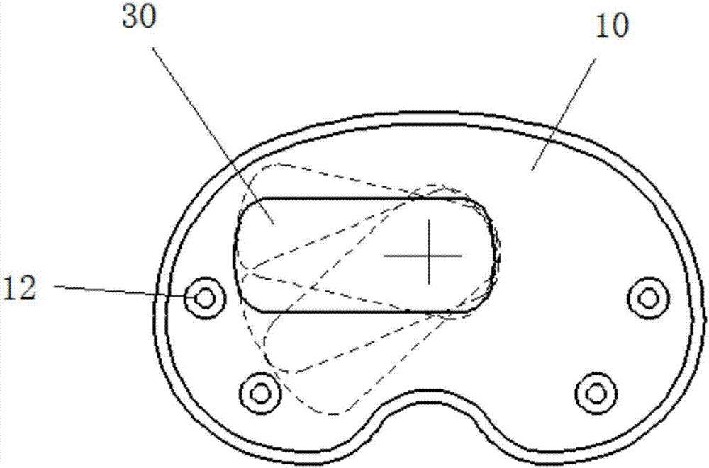 Tibial prosthesis