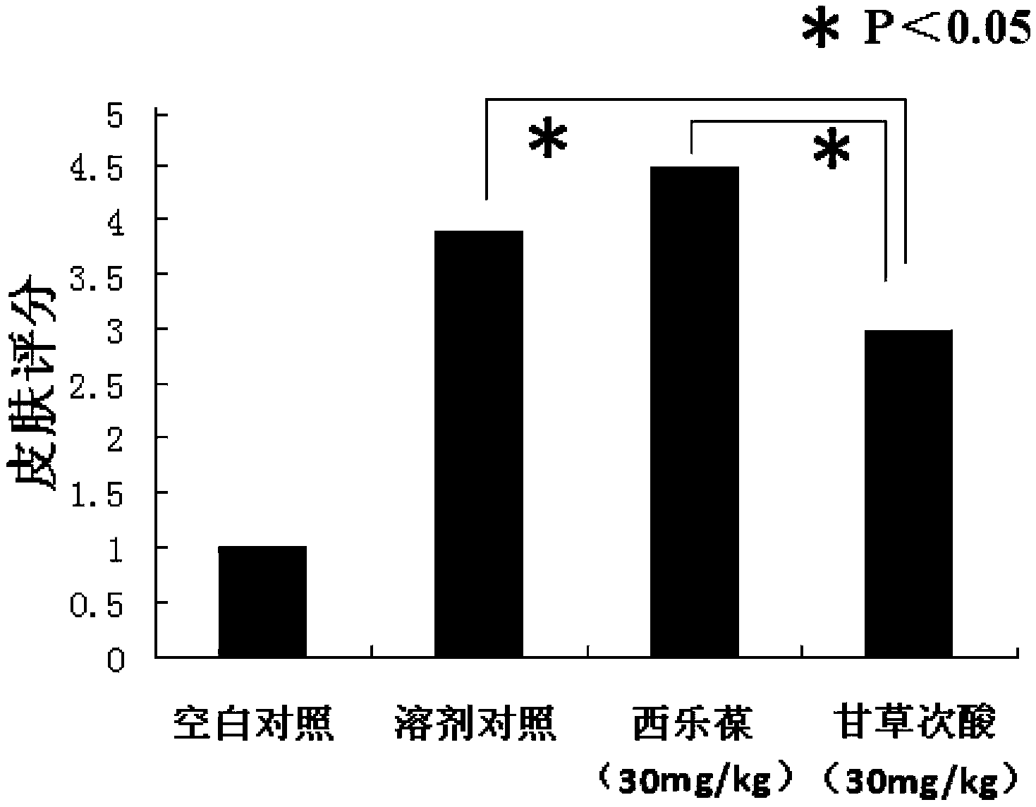 Application of glycyrrhetinic acid and glycyrrhizic acid in preparation of medicines for preventing or treating radioactive soft tissue injury