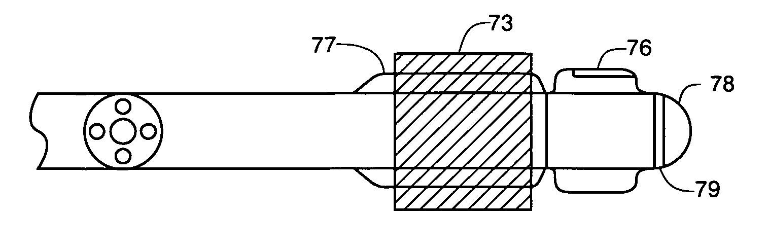 Method of removing particulate debris with an interventional device