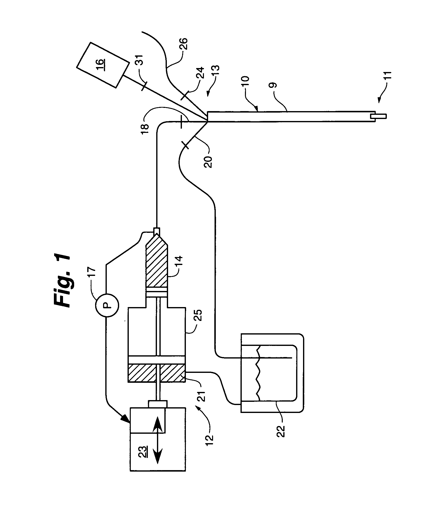 Method of removing particulate debris with an interventional device